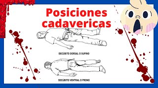 Posiciones de un cadaver en la escena del crimen