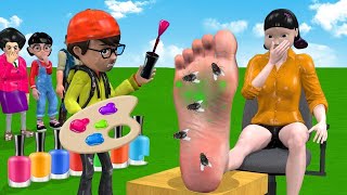 Scary Teacher 3D vs Squid Game  Feet Treatment or Error 5 Time Challenge