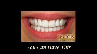 Million Dollar Smile from Kurpis Dentistry