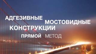 Ольга Пономаренко. Адгезивные мостовидные конструкции.Промо