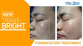 TRANX-BRIGHT For All Types Of Pigmentation