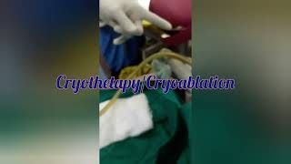 Cryotherapy/Cryoablation#what#why#how@vivekanandahospitalofficial