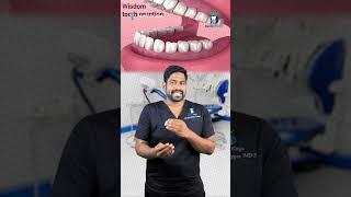 எது ஞானப்பல்? How to identify wisdom tooth? | Dr. Karthikeyan | Denta Kings