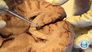 Brain Overview and Axial Dissection