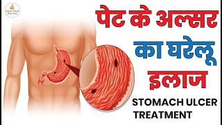 पेट के अल्सर का घरेलू इलाज | Pet Me Ulcer Ka Gharelu Upay | Stomach Ulcer Treatment In Hindi