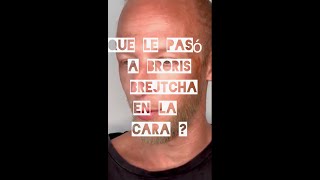 Que les pasó a #BorisBrejcha en la cara ?