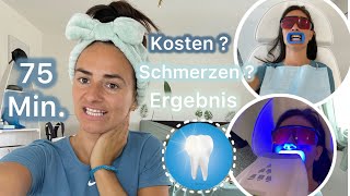 Weiße Zähne in 75 Minuten 🦷💎 vorher nachher | Schmerzen | Kosten | Familienvlog | Marytuga