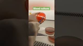 blood culture #shorts