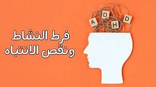 مرض فرط النشاط ونقص الانتباه ما هو وكيفية العلاج