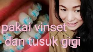 TUTORIAL cara pemasangan karet behel power O sendiri pakai tusuk gigi dan vinset MUDAH.