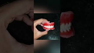 complete denture