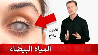 علاج طبيعي للمياه البيضاء أو اعتام عدسة العين - دكتور بيرج