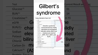 Gilbert’s syndrome impacts about 10% of the population! #gilbertssyndrome #liverdisease #nutrition