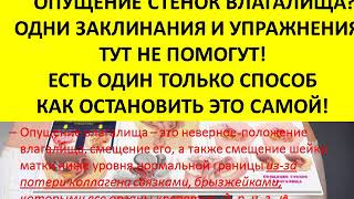 опущение стенок влагалища лечение