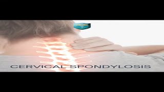 Cervical Spondylosis Pain #chronicpain #cervical_spondylosis #explore