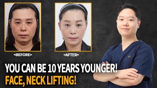 Let's find out about smas face lifting and neck lifting | Face lifting | Neck lifting