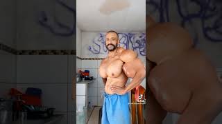 Real Life Hulk 🧟‍♂️ Freak Bodybuilder 😱 Whoe injects Synthol 💉