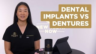 Dental Implants vs. Dentures