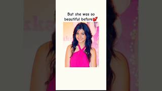 Anushka Sharma before surgery💕#cover#atifaslam#ytshorts#shorts#shorts#trending#viral#bollywood