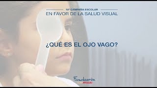 ¿Qué es el ojo vago?