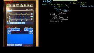 Principles of Mechanical Ventilation 11: Modes - Pressure control