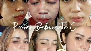 Bebwhite c skincare || Bebwhitec bpom ampuh 082338106800