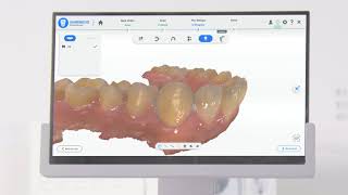 Shining3D Aoralscan 3 Intraoral Scanner - PreDesign Upload Data to Cloud