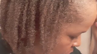 Hair Growth Update!! Living With Alopecia!!! Fine 4C Hair