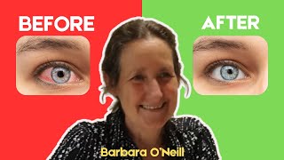 These Are 5 Best NATURAL METHOD To Treat & Improve Your VISION (REMEDIES CASTOR OIL)🔥Barbara O'Neill