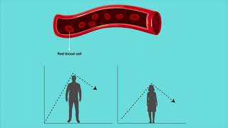 New Study on Changes in Complete Blood Count Reference Intervals with Sex and Age in Ann Lab Med