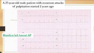 MD Revision ECG   Dr  Mervat Aboulmaaty