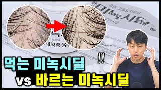 먹는 미녹시딜이 탈모치료에 더 효과적인 이유 (feat. 최신 논문)