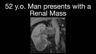 Renal Cell Carcinoma Case 1