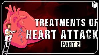 Treatments of Heart Attack | Part-2 | PuStack