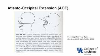 Preop Airway Evaluation and Prediction (Dr. Hessel)