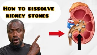 How to dissolve kidney srones with stone breaker leaves