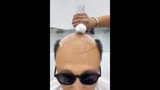 amazing hair transformation 😱  Hair patch for men   hair wig thin