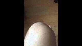 Knee popping sound