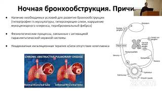 Особенности нарушений дыхания во сне у пациентов с обструктивными заболеваниями легких