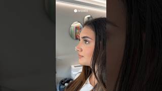 Natural look 6 weeks after Closed Scarless Rhinoplasty | Dr. med. Simon Zimmermann