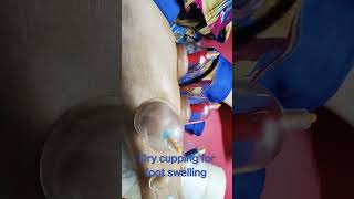 #cupping #swelling #sprain #healing #pain #physiotherapy #physio #educational #orthoneurocarecenter