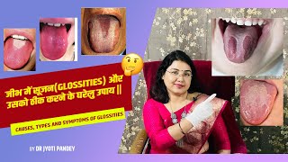 जीभ में सूजन(GLOSSITIES) और उसको ठीक करने के घरेलु उपाय ||