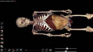 Огляд EFAST-протокол. ОНМедУ. Anatomage table