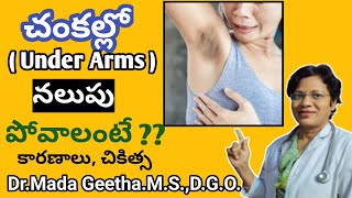 చంకల్లో నలుపును ఎలా వదిలించుకోవాలి??/Medical Treatment/Home Remedies in Telugu#geetha'shealthcare