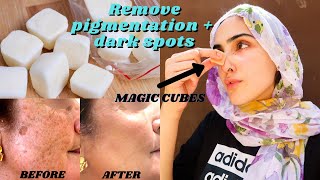 How To REMOVE DARK SPOTS, PIGMENTATION + MELASMA AT HOME *NATURAL* ~ Immy