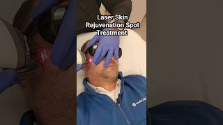 Elevate your grooming game! Check how quick this Fraxel Laser Skin Rejuvenation treatment was.