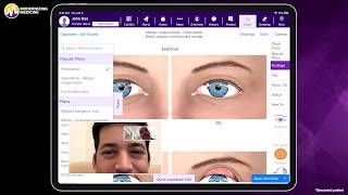 Using an Ophthalmology Telehealth-Enabled EHR System