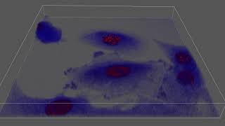 Cisplatin Treated Lung Cancer (A549) with biosensors