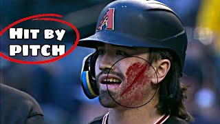 MLB- Worst Hit By Pitch• Part 5