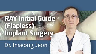 RAY Initial Guide (Flapless) Implant Surgery_by Dr. Inseong Jeon